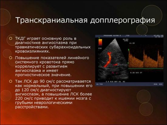 Транскраниальная допплерография