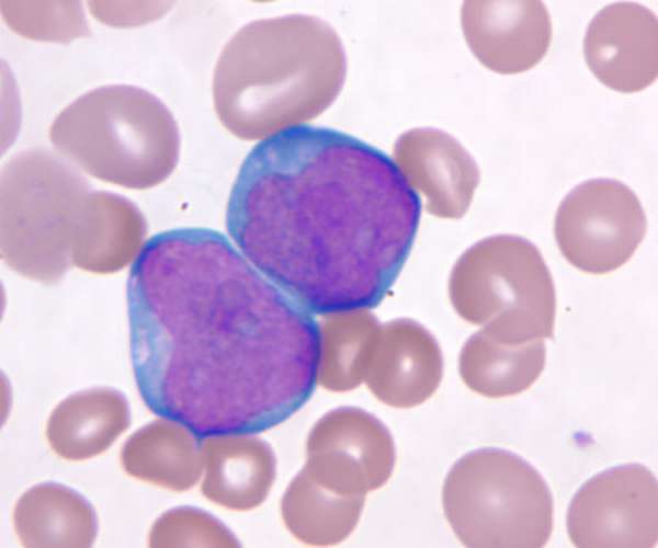 Нормы бластных клеток в анализе крови, диагностика и расшифровка результатов