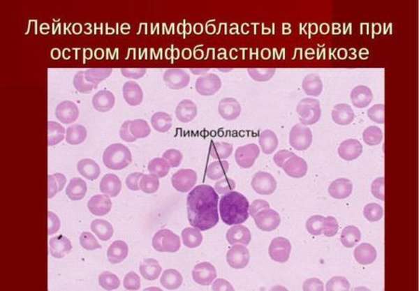 Нормы бластных клеток в анализе крови, диагностика и расшифровка результатов