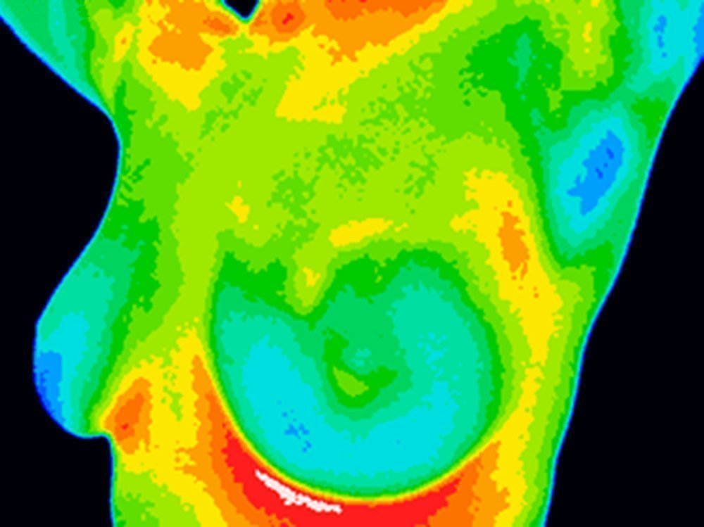 Термография для диагностики болезней молочных желез
