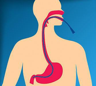 duodenal intubation reviews